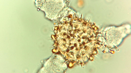 Identyfikacja pyłku/pyłków przewodniego (1)