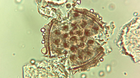 Identyfikacja pyłku/pyłków przewodniego (2)